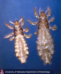 lice nannies usa lice picture